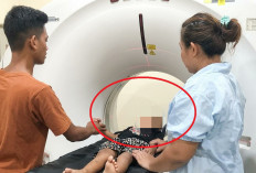  Akibat Dibanting Penculik, Kepala Bocah di Curup Harus Dioperasi 