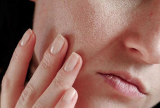 Pori-Pori Makin Terlihat Besar ? Ini Penyebabnya dari Kebiasaan Kecil yang Tidak Disadari