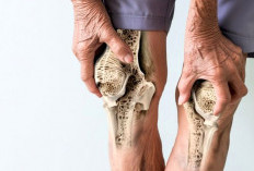 Mau Tulang Sehat dan Kuat ? Hindari 7 Makanan Pemicu Osteoporosis Ini