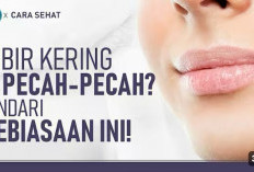 Catat! Ini Dia Penyebab Bibir Kamu Pecah-Pecah