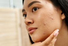 Bye Jerawat dan Minyak ! Ini Tips Ampuh Rawat Kulit Wajah Khas Orang Indonesia