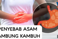 Jangan Abaikan! Ini Pemicu Asam Lambung Kambuh