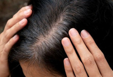  Sampo Penghitam Rambut Aman atau Berisiko ? Ini Fakta yang Perlu Kamu Ketahui